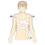 QHeart Sensor Electrode Strip (10-pc pack) - Please Specify Size